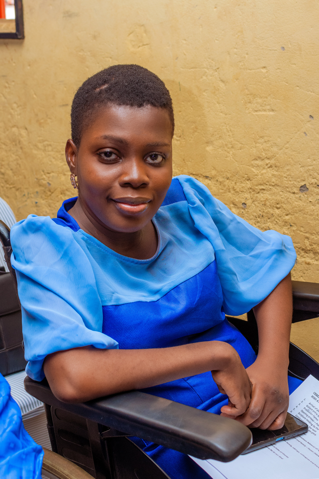 Hydrocephalus How Funto coped with discrimination to strengthen her