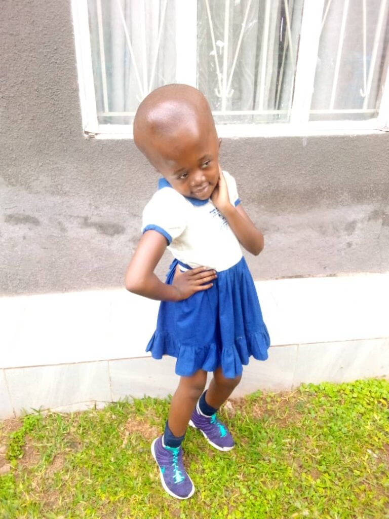 Mitchell Hydrocephalus